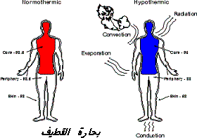 اخطار الغوص  Hypoth10