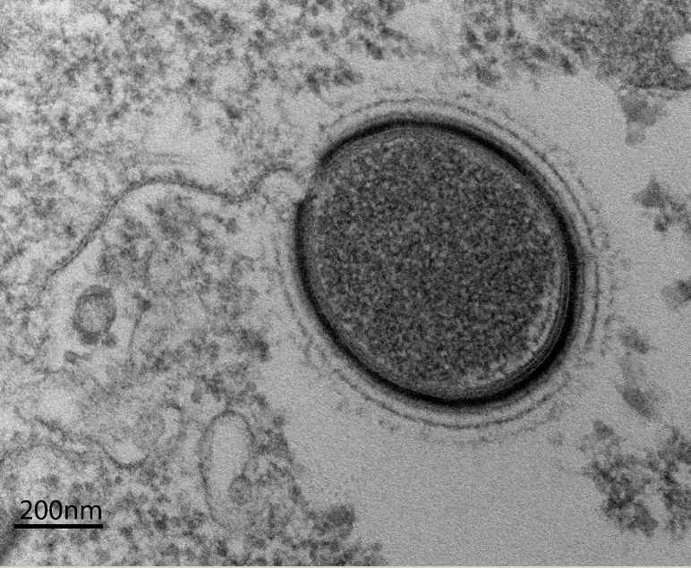 Découverte d’un nouveau virus géant en Sibérie 2048x110