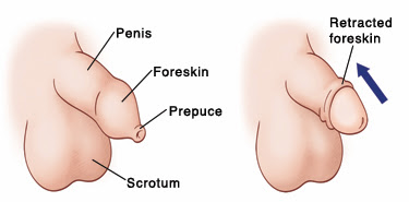 Fimosi e circoncisione