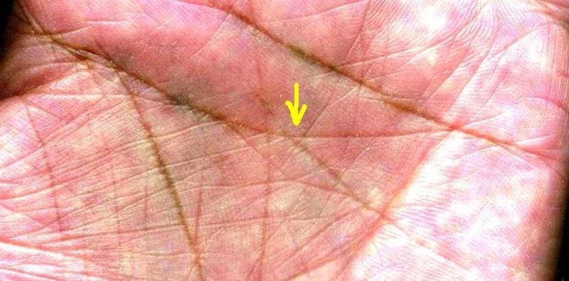rhombus shaped LOOP formation along the lines of HEAD in the palm Not-lh10