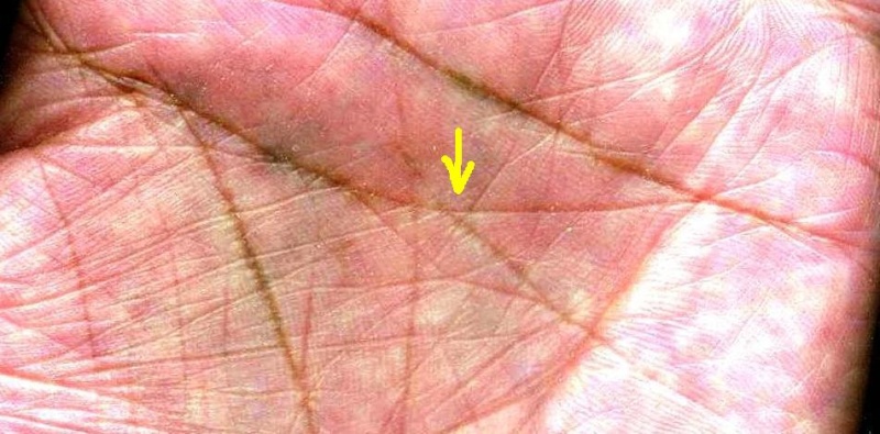 rhombus shaped LOOP formation along the lines of HEAD in the palm  Not-lh10