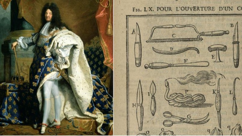 Louis XIV - Page 15 Xvm5e110