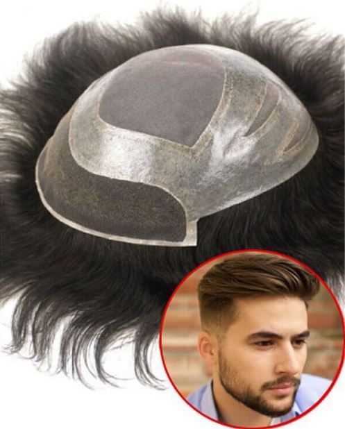 How Long Do Mens Hair Replacement Systems Last？ 1_1_10