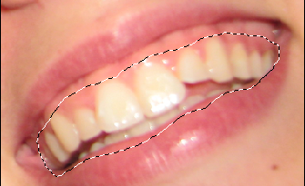[simple] Dents blanches =p Tuto2h10