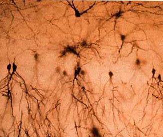 image microscopique Neuron10