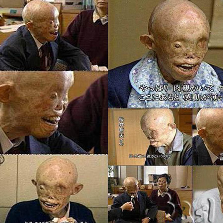 هذا هو الرجل الذي نجا بعد القنبلة الذرية على هيروشيما..... 28022011