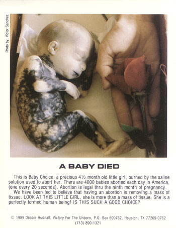say no to aborsi!!! 310