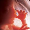 bebe - Razvoj bebe od I do XL nedelje trudnoće 19_ned10