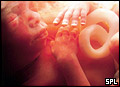 Razvoj bebe od I do XL nedelje trudnoće 2010