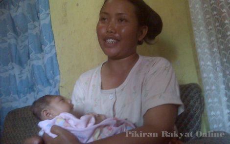Bayi Tanpa Tempurung Kepala Berharap Bantuan Operasi Batok11