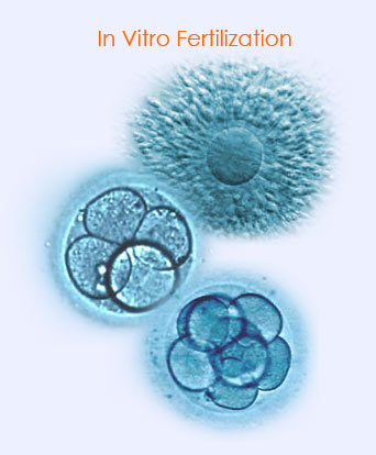 IVF - In Vitro Fertilization Ivf10
