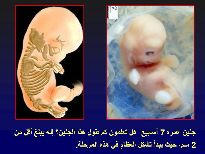  صور مكبرة عن مراحل تكوين الجنين ،، سبحان الخالق 728
