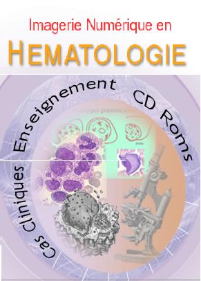 l'imagerie numérique en hématologie Sans_t14