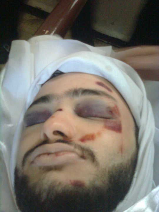 البطل الشهيد "وسيم كروما" الذي سقط في مجرزة حمص Ououus13