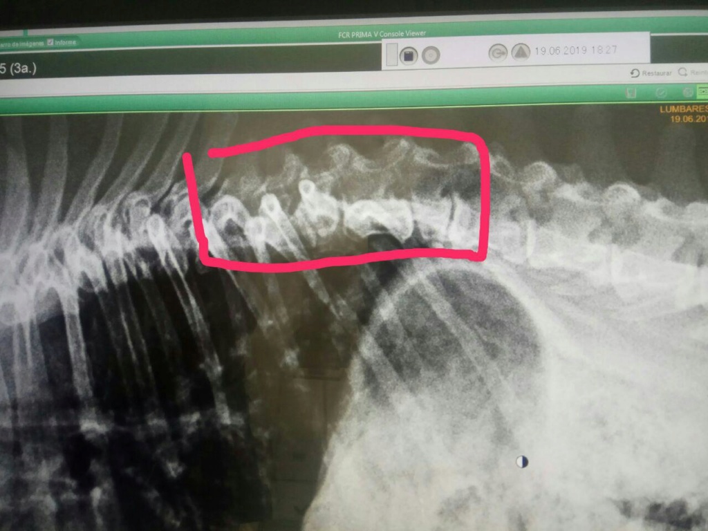 HEMIVERTEBRA - Página 5 Hemi_h10