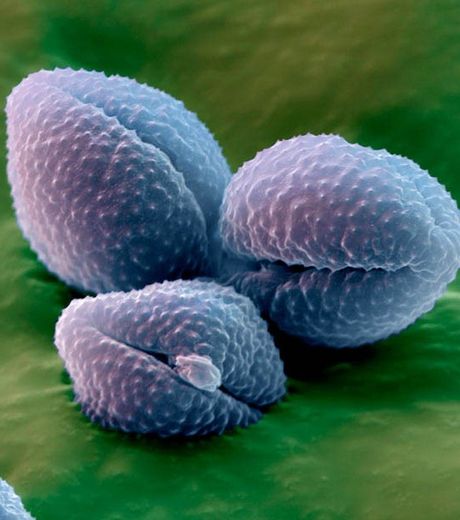 Le pollen : de minuscules grains photographiés au microscope  Le-pol10