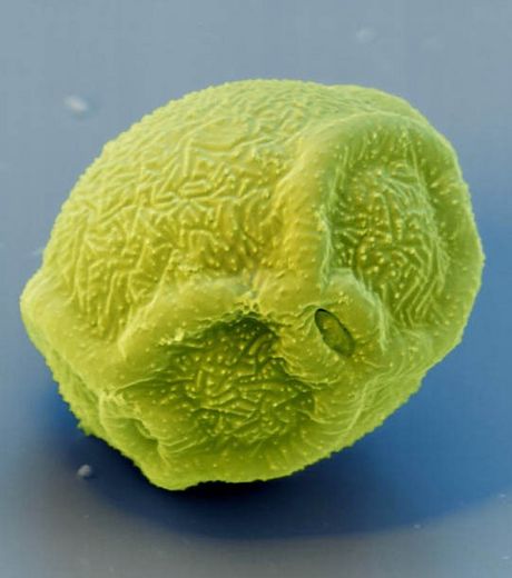 Le pollen : de minuscules grains photographiés au microscope  Un-gra10