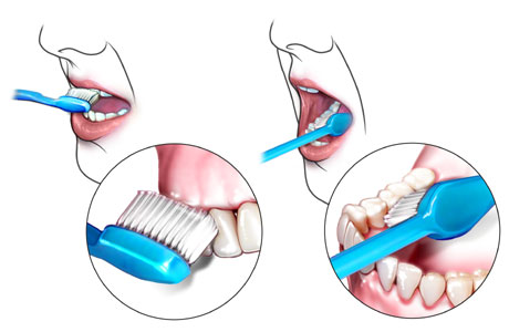 الطريقة السليمة لغسل الاسنان D6e59c10