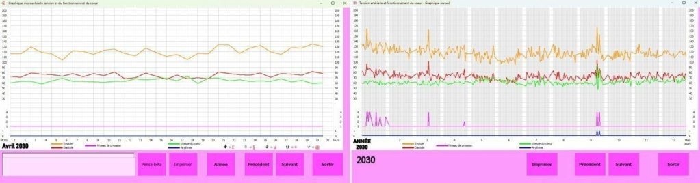 Cardiographix Coeur-11