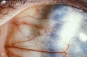 Spot diagnosis of ophthalmology Interc10