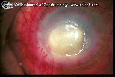 Spot diagnosis of ophthalmology Neurop11