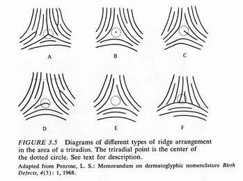 The TRIRADIUS in a fingerprint: how it develops, it's characteristics + a definition! - Page 2 3-12-212