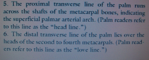 How to discriminate a simian crease from a Sydney line and a Suwon crease! - Page 3 Distal15