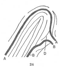 The TRIRADIUS in a fingerprint: how it develops, it's characteristics + a definition! - Page 16 Fig02410