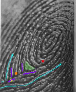 The TRIRADIUS in a fingerprint: how it develops, it's characteristics + a definition! - Page 17 Patti-10