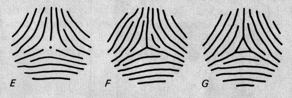 The TRIRADIUS in a fingerprint: how it develops, it's characteristics + a definition! - Page 6 Penros15