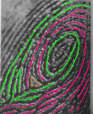 The TRIRADIUS in a fingerprint: how it develops, it's characteristics + a definition! - Page 17 Triang14