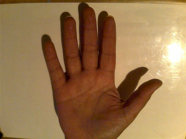 Fourth phalange on my little finger Right-11
