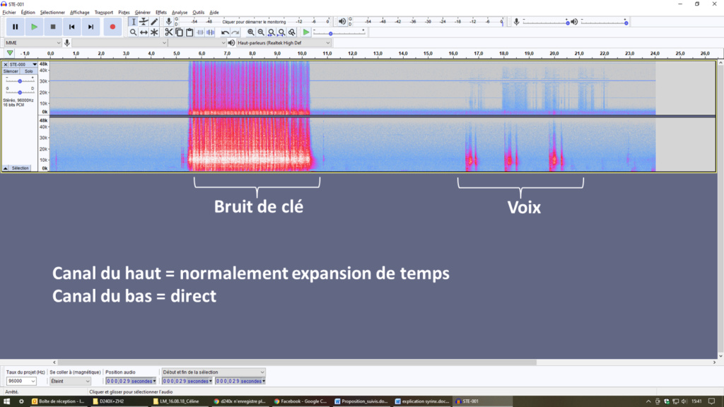 Problème D240x Expansion de temps Audaci10