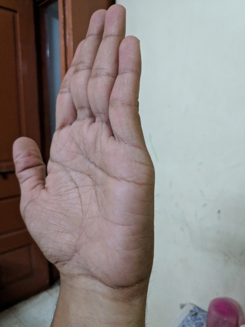 About my palm 20190416
