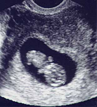 bebe - Razvoj bebe od I do XL nedelje trudnoće 00190010