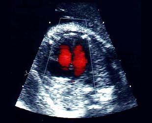 bebe - Razvoj bebe od I do XL nedelje trudnoe 2710