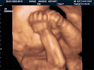 bebe - Razvoj bebe od I do XL nedelje trudnoće 3310