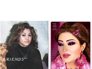 فنانات قبل وبعد عمليات التجميل 411