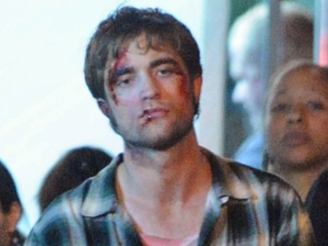 Robert Pattinson ensanglanté ! Bobo10