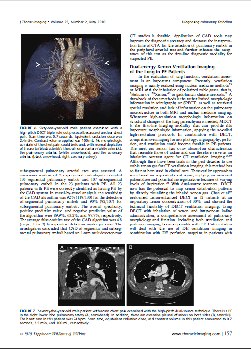 Journal of Thoracic Imaging volume 25-2010 412