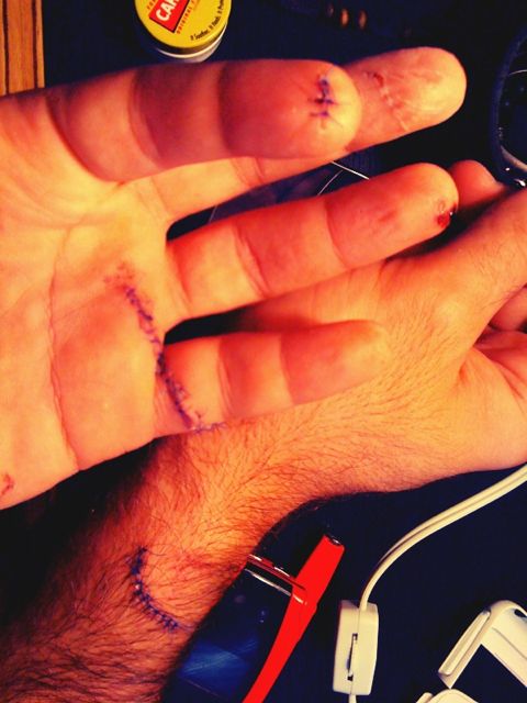 Jaime Camil muestra sus puntadas por accidente grabando comercial EGO Puntad10