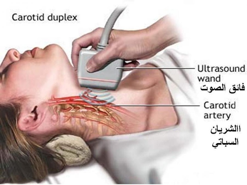 الامراض التي تصيب المخ 810