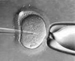 Embrion triju roditelja Embrio10