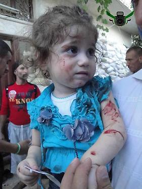 صورة مؤلمة للطفلة جنى التي أصيبت بشظايا صاروخ ضرب منزلها في القصور بحمص Proxy11