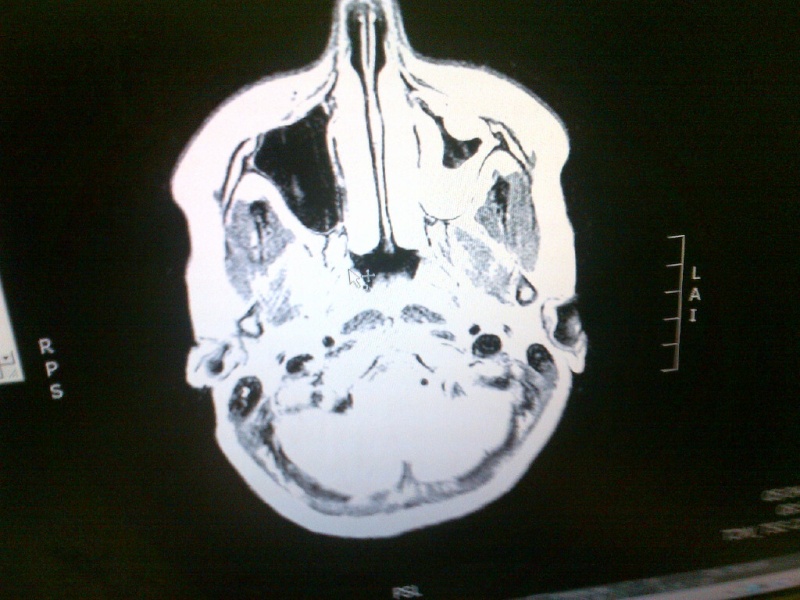 My MRI Scan Img-2011