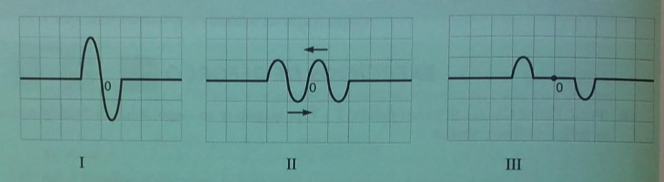 Superposiçao de ondas A16