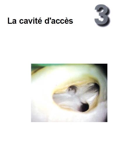 La cavité d'accès 55067110