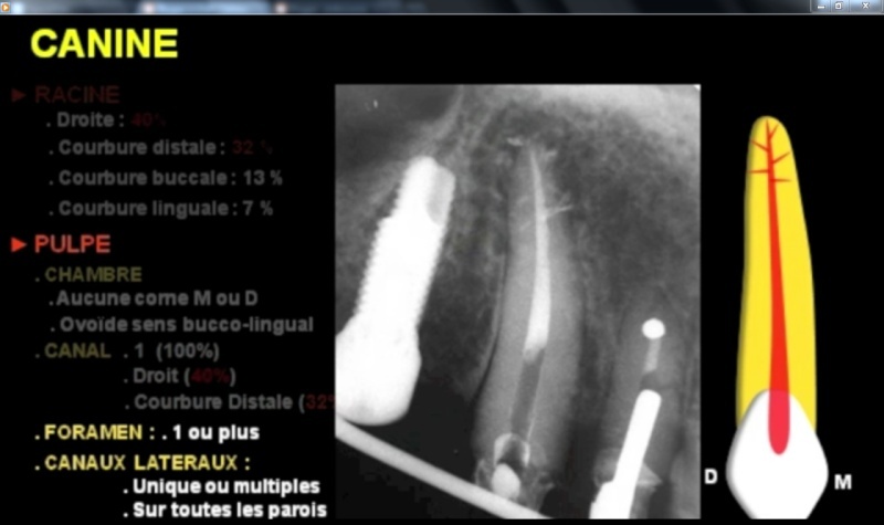 Anatomie endodontique des canines [vidéo] Caninz10