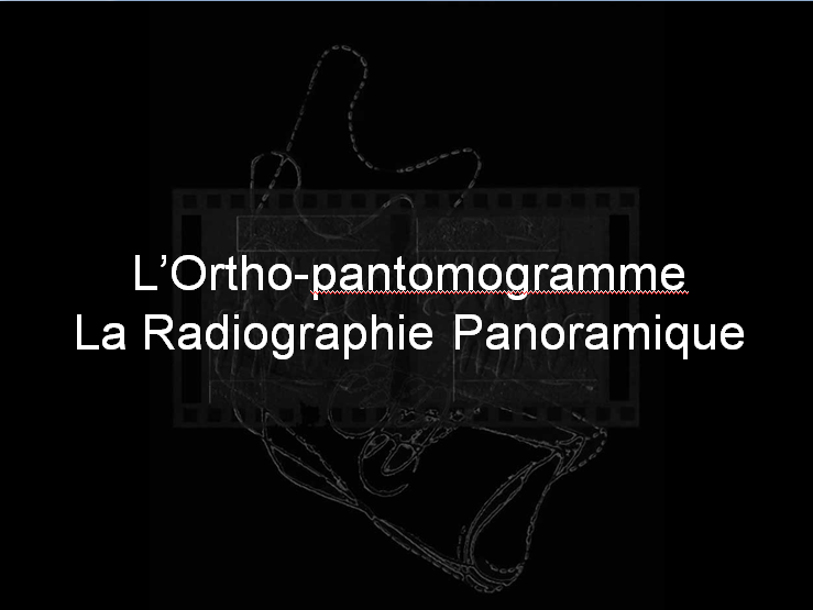 La radiographie panoramique Sans_t18