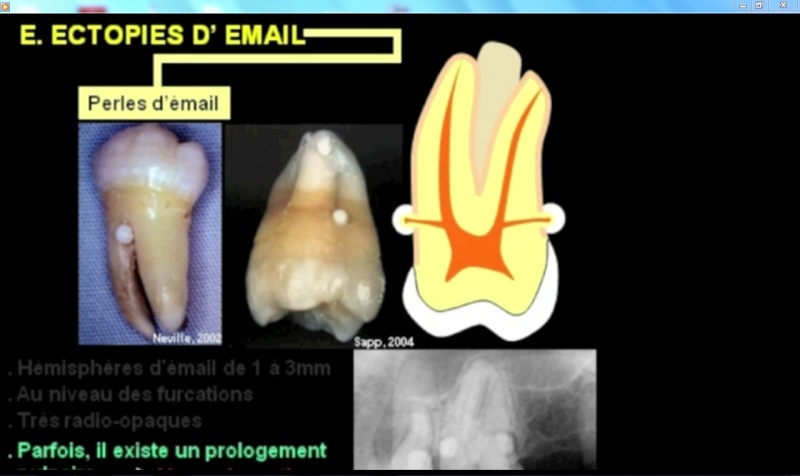Les anomalies dentaires -morphologiques- [vidéo] Sz10